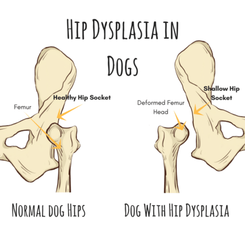 An illustration of Hip Dysplasia